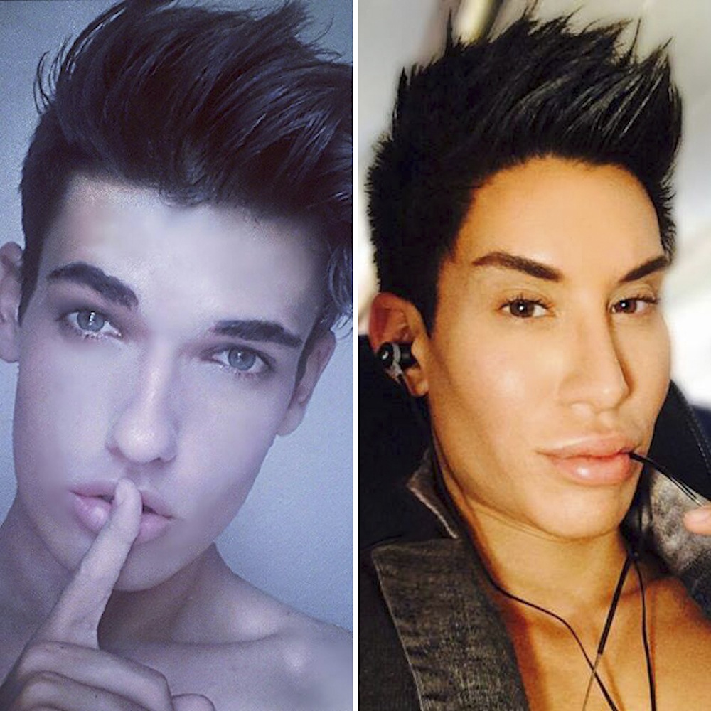 Real Life Ken Doll Before And After